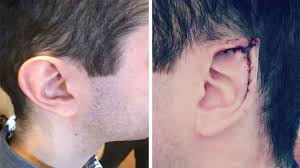 I bought some logitech headphones to see if they would be big enough. Fantasy Fanatic Who Splashed 60k Transforming Himself Into Real Life Elf Reveals New Pointed Ears And Anime Jawline Storytrender