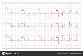 Heart Cardiogram Chart Vector Set Healthy Heart Rhythm