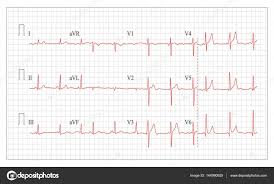 Heart Cardiogram Chart Vector Set Healthy Heart Rhythm