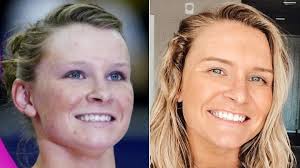 Olympic Gymnasts You Don't Hear About Anymore