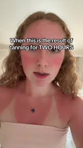 Burning When Tanning
