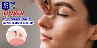 TỤ DỊCH SAU NÂNG MŨI: DẤU HIỆU VÀ CÁCH XỬ LÝ AN TOÀN