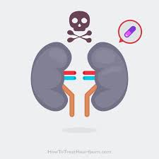 Ppis Linked To Chronic Kidney Disease How To Treat Heartburn Kidney Disease How To Treat Heartburn Chronic Kidney Disease