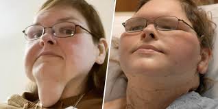 See Tammy Slaton's Transformation After Skin Removal Surgery