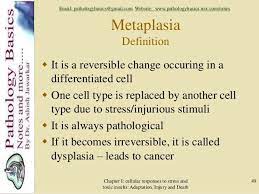 Metaplasia Definition Http Medical Dictionary Thefreedictionary Com Metaplasia Paramedic Study Cancer Killers Stress