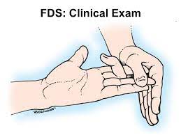 The fdp sit deep to the fds in the tunnel. Flexor Tendon Injuries Of The Hand Ppt Video Online Download