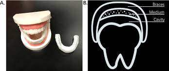 Most often, the dentist removes the decayed portion of your tooth with a drill. Team Hzau China Hardware 2020 Igem Org