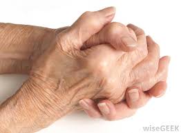 Check spelling or type a new query. What Is A Rheumatoid Nodule With Pictures