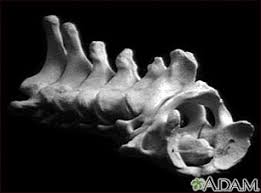 Learn vocabulary, terms and more with flashcards, games and other study tools. Vertebra Cervical Neck Medlineplus Medical Encyclopedia Image