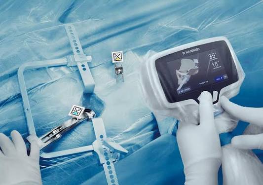 Benefits of Assisted Hip Replacement