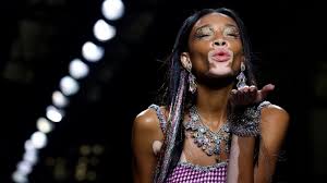 We did not find results for: Winnie Harlow Privat Leben Und Karriere So Lebt Das Model Mit Den Weissen Flecken News De