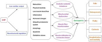 We did not find results for: New Insights Into The Pathogenesis And Treatment Of Sarcopenia In Chronic Heart Failure