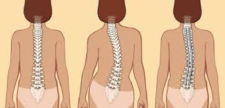 Iskelette, göğüsün arka ve üst yanlarına komşu olarak bulunur. Kurek Kemigi Agrisi Belirtileri Ve Tedavisi Kemik Org