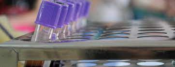 Factor x is synthesized in the liver and requires vitamin k for its synthesis. Factor X Assay