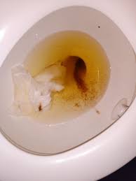 Check spelling or type a new query. Coffee Grounds Discharge Babycenter