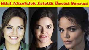 İşte hilal altınbilek'i̇n estetiksiz hali. Bir Zamanlar Cukurova Oyuncularinin Sok Eden Eski Halleri Youtube