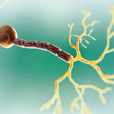 Canavan Disease Symptoms Diagnosis And Treatment