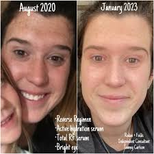 Skincare and makeup community anniversary