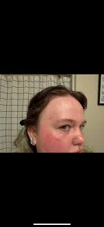 Nothing is irritating than to have a face that is burnt, damaged, too dark  or too light than the rest of your body. Consider your skin care products