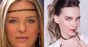 A bichectomia é o tratamento para retirada das bolas de bichat localizadas nas saiba mais sobre a cirurgia plástica de bichectomia. 10 Famosos Con Bichectomia Antes Y Despues Dr Edwin Vasquez