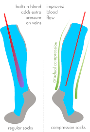 Compression Socks Vs Regular Socks A Brief Comparison By Jt Tobin Medium