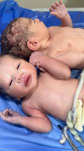 #twins baby hands 🤝🤝