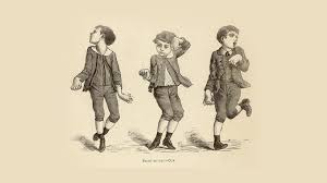 Image result for Chorea