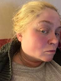 Hey everyone I got diagnosed with Fibromyalgia the first of the year after  dealing with pain for 14 years. All bloodwork has been normal so far but I  have been getting a