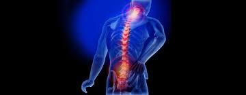 Image result for images back pain