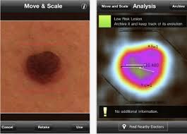 With cute, funny, short jokes, you can turn someone's mood around in a matter of seconds. Diagnosing Skin Cancer Via Iphone The Apps To Know The Atlantic