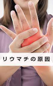 リウマチの原因 関節リウマチ 関節炎 授乳