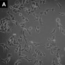 LOX-IMVI Human Melanoma Cell Line