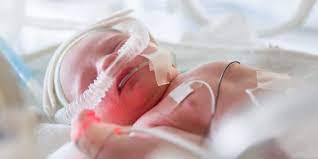The clinical manifestations vary with age, health status, and whether the infection is primary or secondary. Nov 11 Rs Virus Infection Second Leading Cause Of Infant Death Worldwide Umc Utrecht