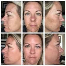 We are thrilled to announce a dynamic 𝐊𝐢𝐧𝐞𝐒𝐲𝐬 collaboration between  our esteemed 𝗗𝗼𝗰𝘁𝗼𝗿 𝗠𝗮𝗻𝘂𝗲𝗹 𝗖𝗲𝗷𝗮 and the talented  𝗘𝘀𝘁𝗵𝗲𝘁𝗶𝗰𝗶𝗮𝗻 𝗠𝗶𝗿𝘁𝗮 𝗦𝗮𝗻𝗱𝗼𝗺𝗶𝗿! 💫✨