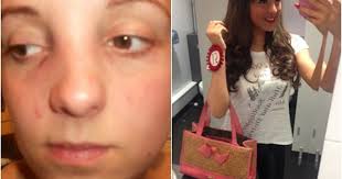 Cô gái thành hot girl sau khi bị bạn trai đánh dập mũi