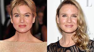 Our surgeon mr miles berry explains the extreme face change of renã©e zellweger. Renee Zellweger S Face Why So Much Criticism Cnn