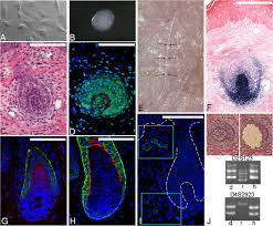 Turn on the dermal papilla hair engine. Microenvironmental Reprogramming By Three Dimensional Culture Enables Dermal Papilla Cells To Induce De Novo Human Hair Follicle Growth Pnas