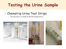 Basic Examination Of The Urine Specimen Ppt Video Online