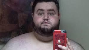 29yo US man loses 136kg and 6kg of skin for wedding