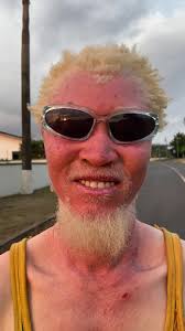 Are you Ready for Me ? #AkwasiBroni -@Ahoufe @Calvin Click #viralvideo...