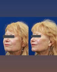 Northwest Aesthetics (@northwestaesthetics) • Facebook