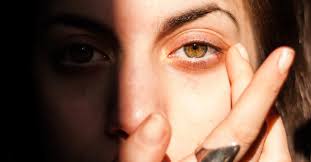 Si vous ressentez tout ou partie de ces symptômes, la première chose à faire est de rester dans le noir et vous pouvez également déposer des compresses froides et humides sur vos yeux pour les soulager. Les Coups De Soleil Dans Les Yeux Causes Symptomes Et Traitement