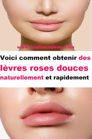 Voici Comment Obtenir Des Levres Roses Douces Naturellement Et Rapidement Skin Care Hair Beauty Face