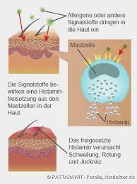 Nesselsucht Urtikaria Symptome Ursachen Behandlung Netdoktor