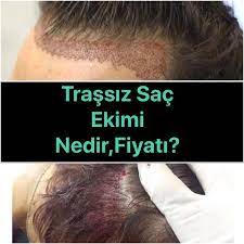 Trassiz Sac Ekimi Nedir Kimlere Yapilir Fiyatlari Ne Kadardir Sac Ekim Uzun Sac
