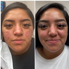 Dr. Matthew Innes Dermatology