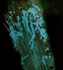 Image result for Tinea Capitis