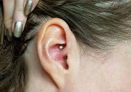 Migraine Piercing 1 Year Results After Daith Piercing For Headaches