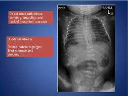 Pin By Sashii Rowe On Radiography Radiography Pediatrics Radiology