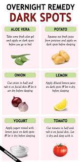 treat dark spots overnight little indian spot dark spots natural skin lightening dark spots on skin